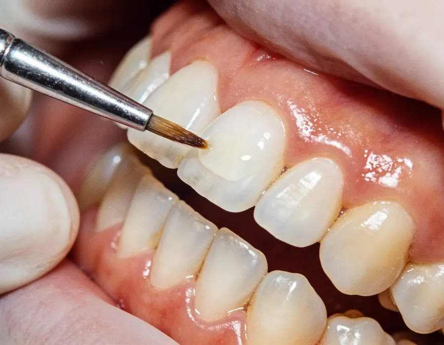 Cosmetic Dentist in islamabad