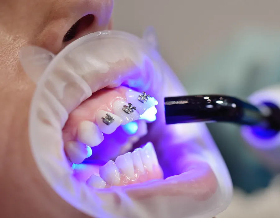 Cosmetic Dentist in islamabad