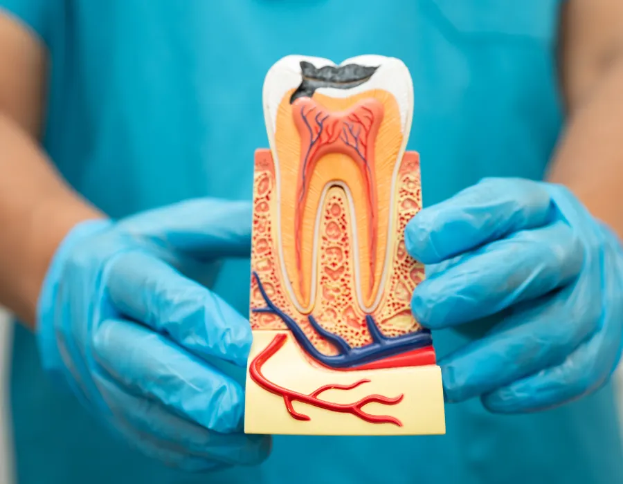 root canal in islamabad