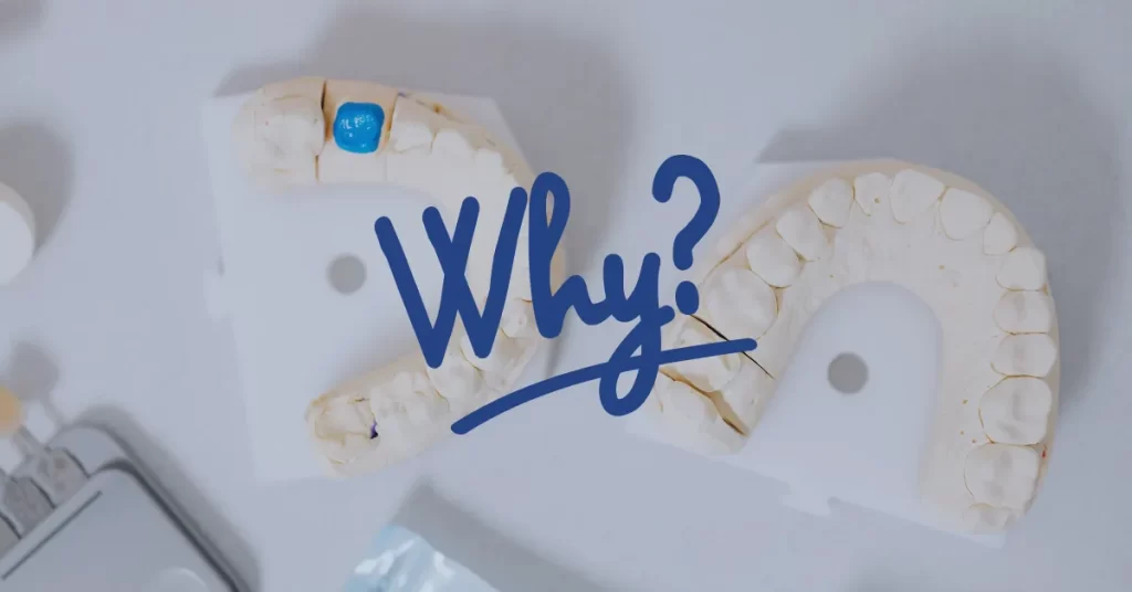 Why Choose Implant-Supported Crowns at Global Dentist