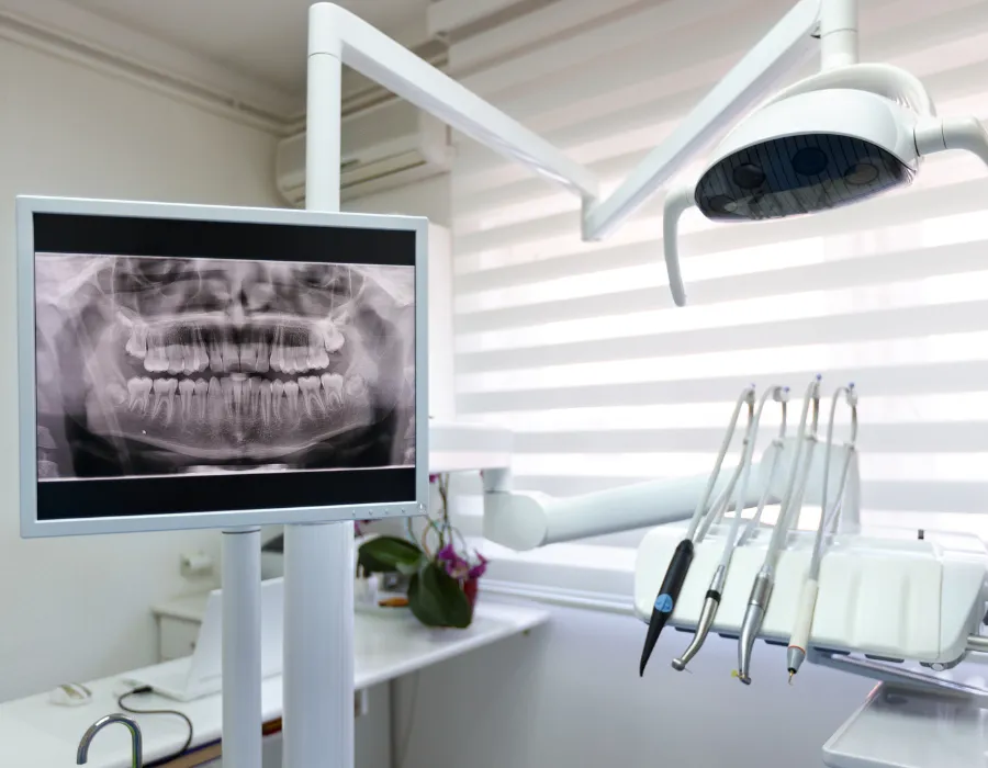 Advanced Dental X-Rays in Islamabad
