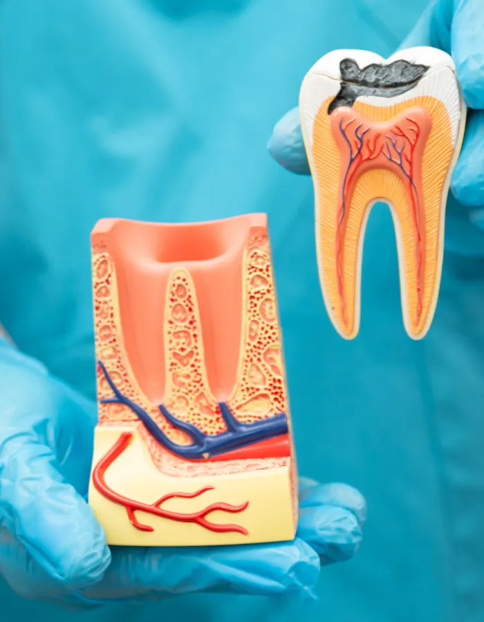 Braces & Dental Implants in Islamabad