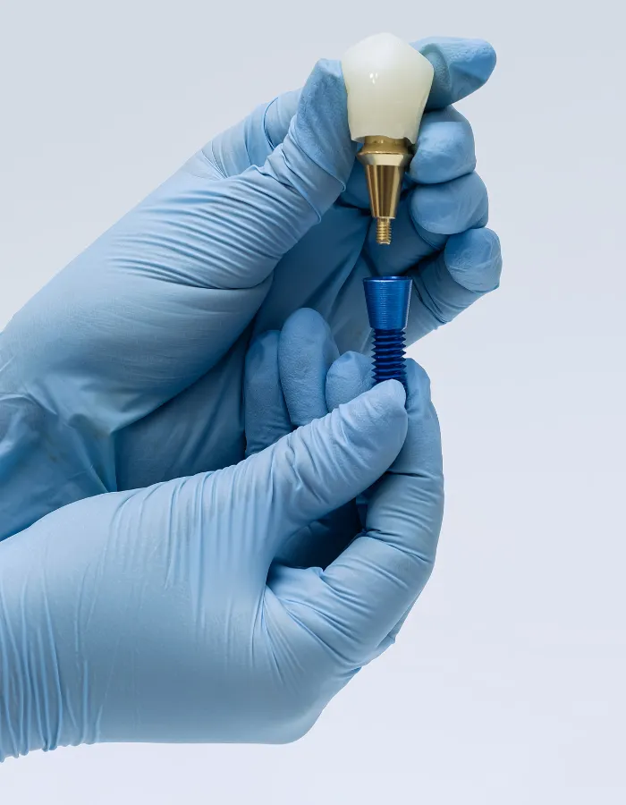 Dental implant in islamabad