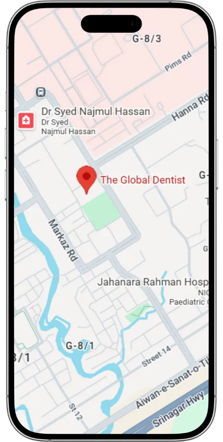 phonemapglobal